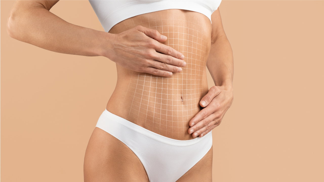 liposuction-in-orlando-lake-mary