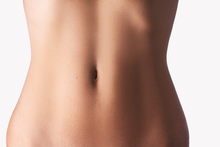 liposuction recovery