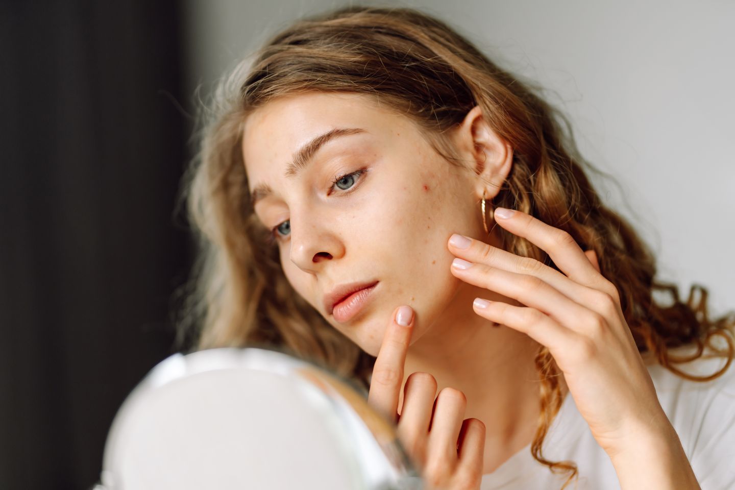Acne Scar Treatment Orlando